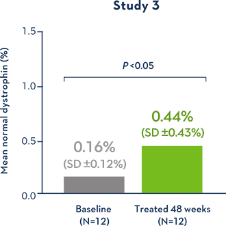 EXONDYS 51 Exon Skipping Sarepta DMD for Healthcare Professionals
